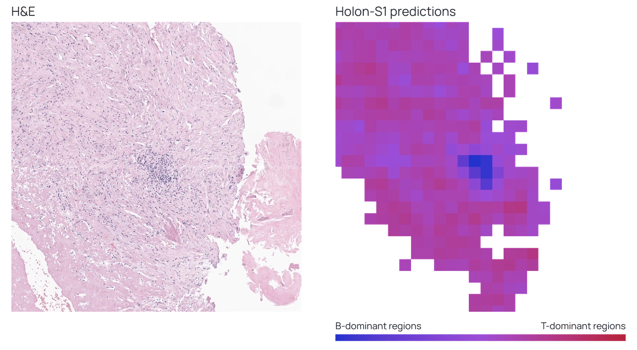 H&E morphology and corresponding Holon-S1 predictions of B- and T-cell-dominant regions.