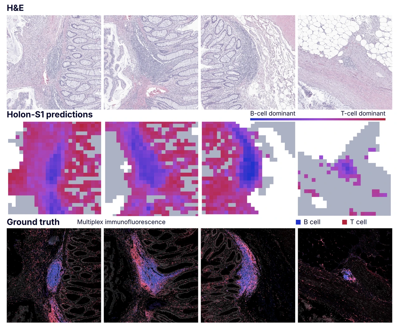 Matched H&E regions, Holon-S1 B- and T-cell predictions, and immunofluorescence ground truth.