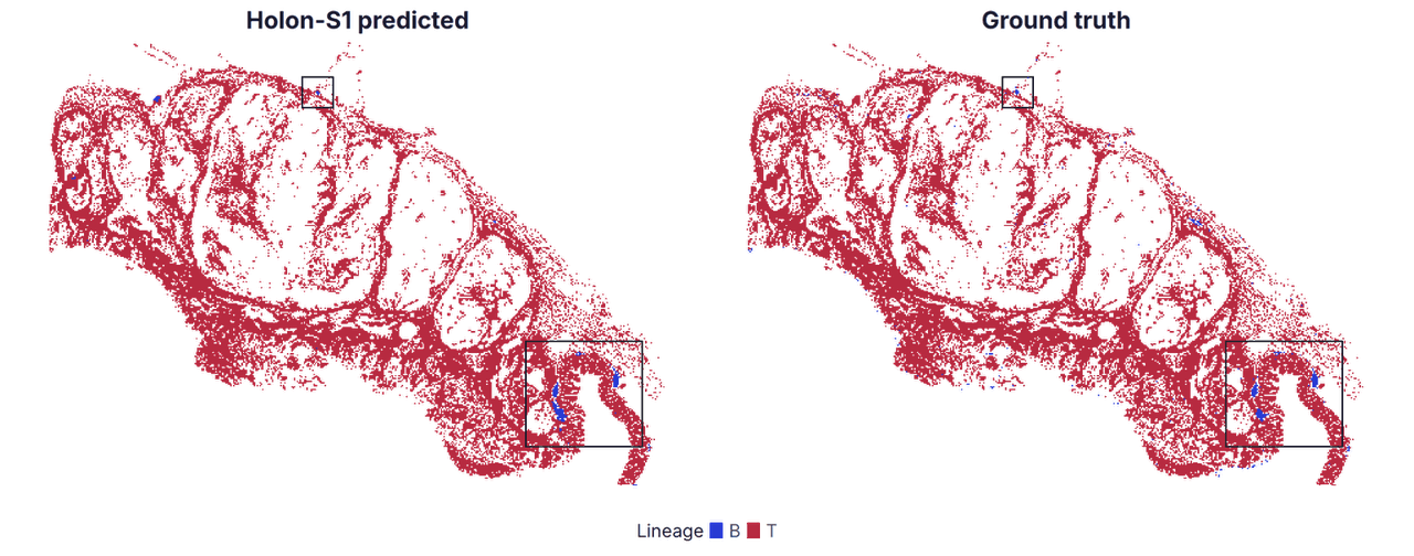 Holon-S1 predictions and immunofluorescence-derived B- and T-cell dominance.