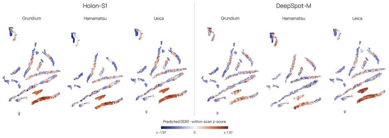 Predicted DDR1 spatial patterns from Holon-S1 and DeepSpot-M for the same prostate biopsy scanned on Grundium, Hamamatsu, and Leica systems.