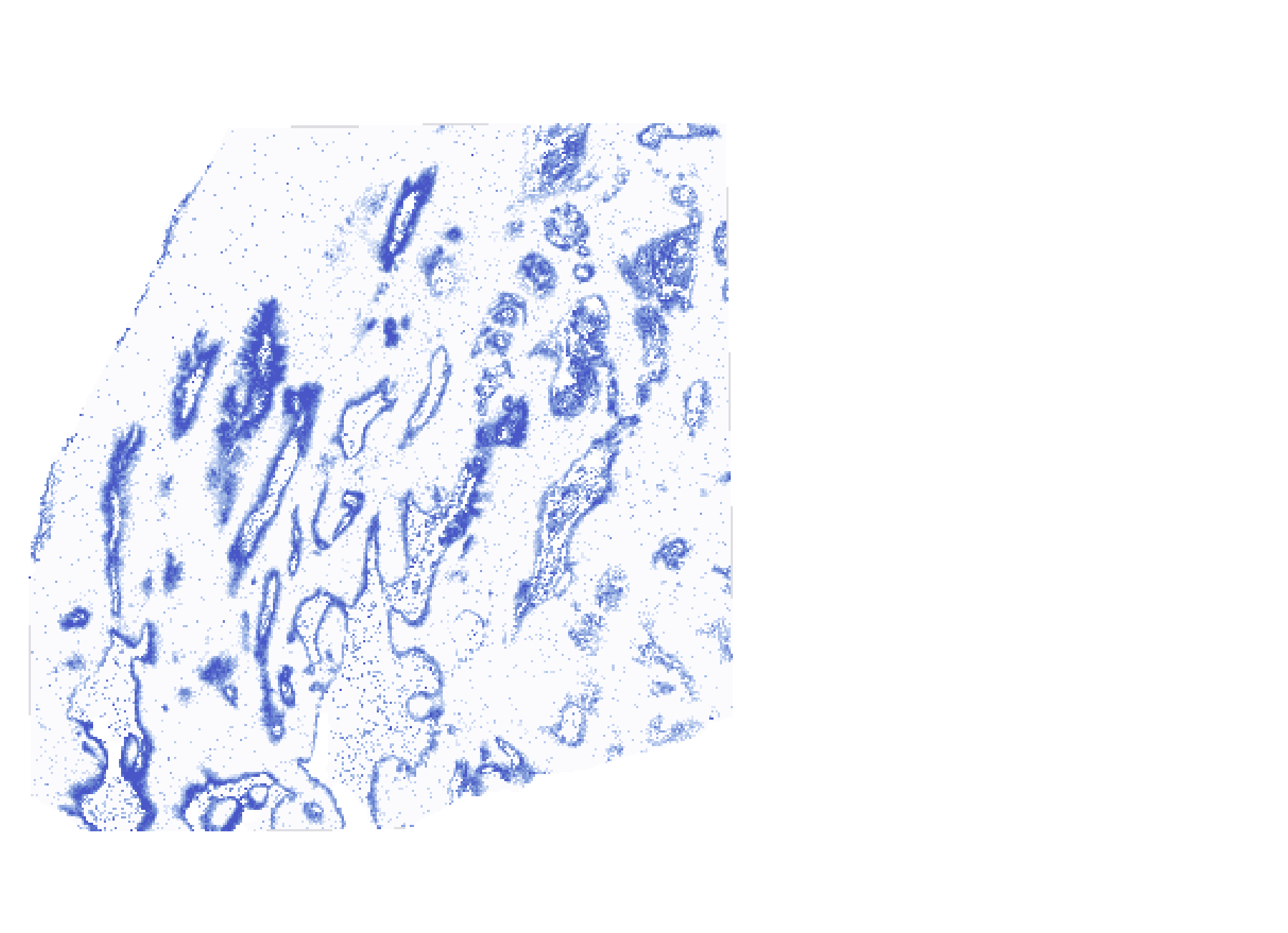 Measured TGM1 expression in non-overlapping regions of the Atera cervical cancer tissue section