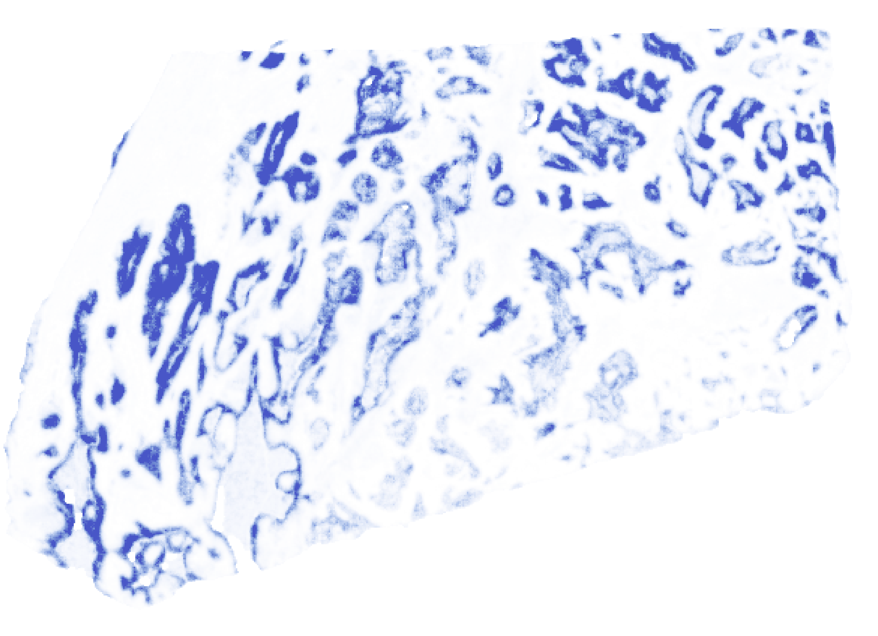 Holon–S1 TGM1 prediction over the full Atera cervical tissue component